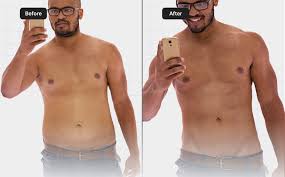 enclomiphene before and after